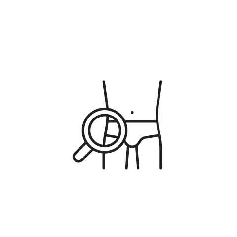Overactive Bladder