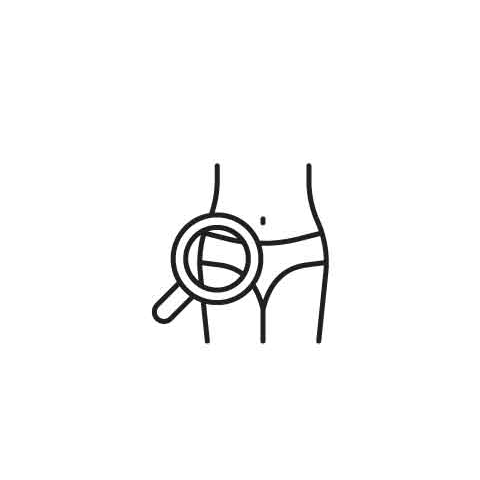 Phimosis